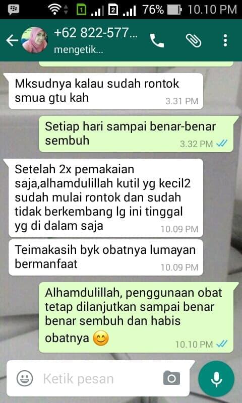 Gambar ini memiliki atribut alt kosong; nama filenya adalah 963a183dd2ea3641a14e96dd8397fd7c.jpg