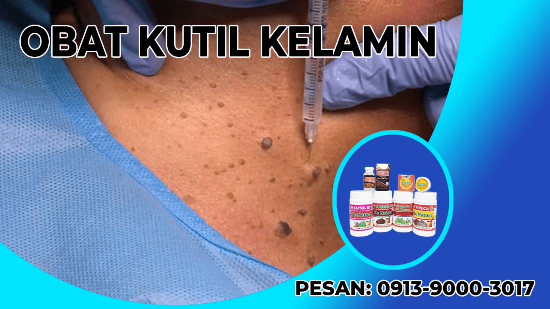 kutil kelamin