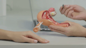 obatkutilkelaminpria