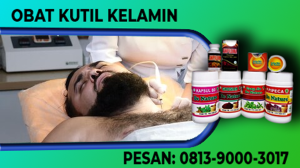 kutil kelamin